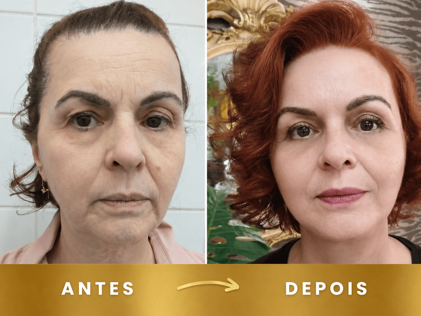 Resultado 4